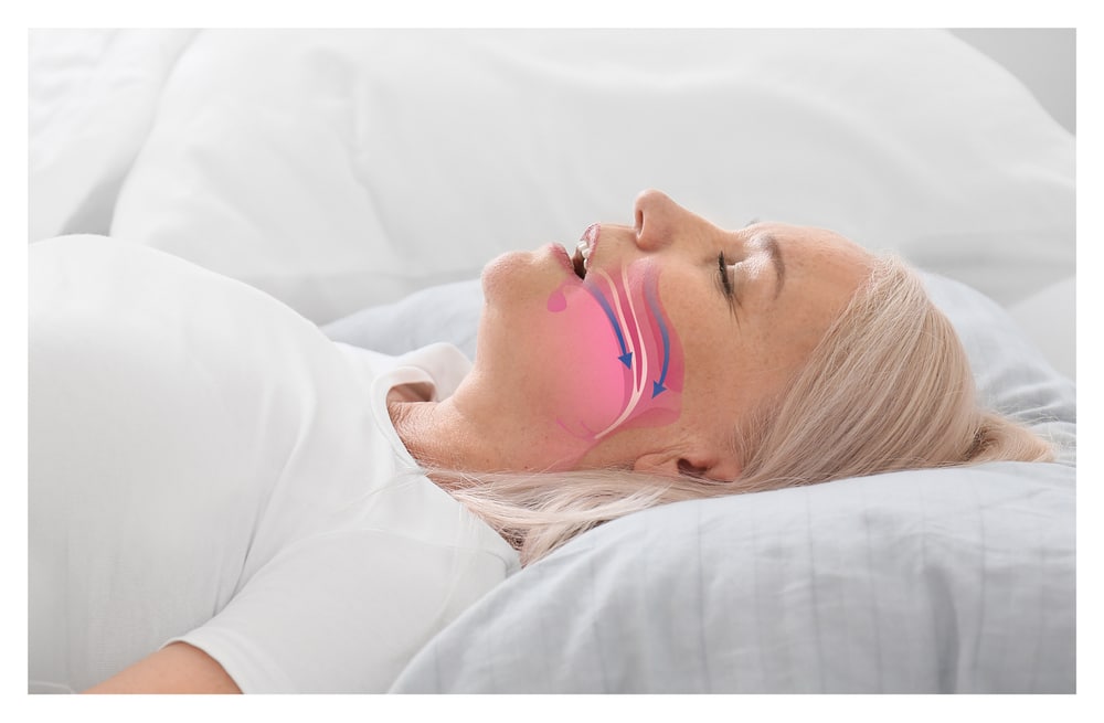 Sleep Apnea South Ogden