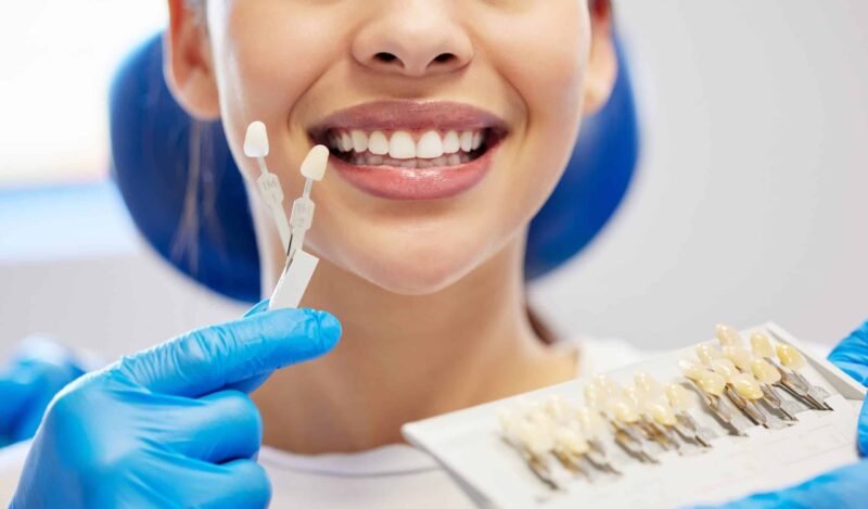 Teeth Whitening South Ogden