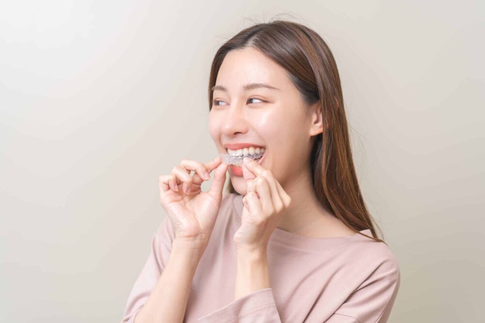 clear aligners south ogden